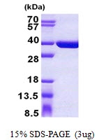 AR50934PU-N - SULT1C4 / SULT1C2