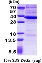 AR50962PU-N - RNASEH2A