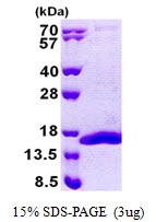 AR50980PU-N - Complex IV subunit Vb