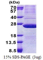 AR51072PU-N - ATP synthase subunit d