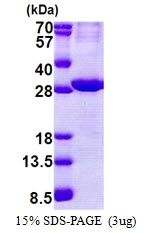 AR51081PU-N - ATP1B2