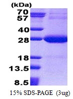 AR51137PU-N - NDUFV2