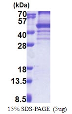 AR51153PU-N - EBNA1BP2