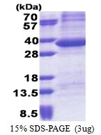 AR51154PU-N - PPP1R3B