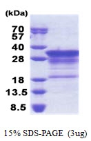 AR51172PU-N - Myelin Basic Protein
