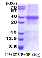 AR51197PU-N - UBE2R2