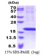 AR51203PU-N - RPS18