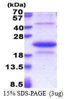 AR51218PU-N - EDA2R / TNFRSF27