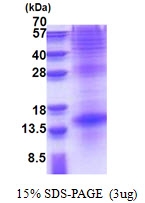 AR51247PU-N - Thyrotropin beta chain