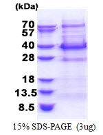 AR51266PU-N - Bcl-7C