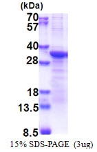 AR51308PU-N - PCSK1N