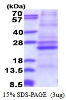 AR51336PU-N - ATP5F1