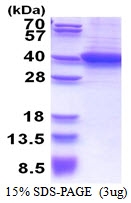 AR51342PU-N - RLBP1