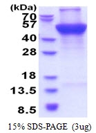 AR51414PU-N - UQCRC1 (Complex III subunit core 1)