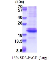 AR51461PU-N - Adiponectin