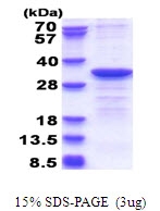 AR51499PU-N - CYB5R2