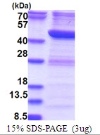 AR51555PU-N - RTCD1