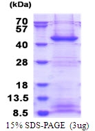 AR51572PU-N - FBXO2