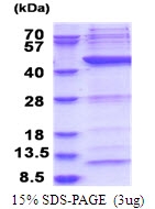 AR51573PU-N - POLR1C