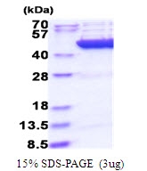 AR51626PU-N - Citrate synthase