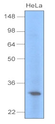 AM09040PU-N - Uracil-DNA glycosylase (UNG)