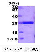 AR09138PU-L - GSTM1
