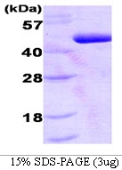 AR09115PU-L - PDK1