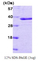 SA6014 - PTPN1