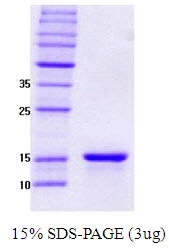 SA6012 - Gamma-Synuclein / SNCG