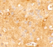 AP55538PU-N - KCNK12