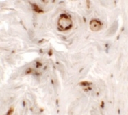 AP55558PU-N - Uroplakin-1b (UPK1B)