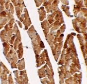 AP55563PU-N - Transglutaminase-5 (TGM5)