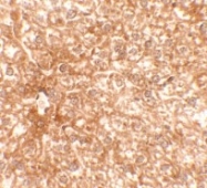 AP55604PU-N - RAPGEF4