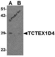 AP55501CP-N - TCTEX1D4
