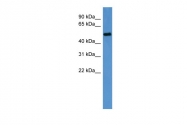 ARP30159_P050 - Cyclin A2