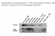 ARP30159_P050 - Cyclin A2