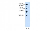 ARP30161_P050 - Cyclin B1