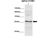 ARP30161_P050 - Cyclin B1