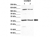 ARP30163_P050 - Cyclin D1