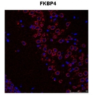 ARP30180_P050 - FKBP4