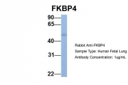 ARP30180_P050 - FKBP4