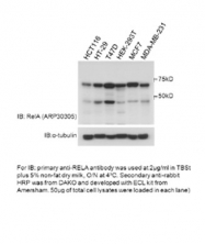 ARP30305_P050 - RELA / NF-kB p65
