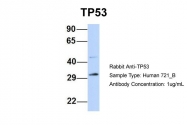 ARP30307_P050 - TP53 / p53