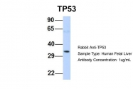 ARP30307_P050 - TP53 / p53