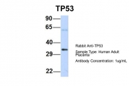 ARP30307_P050 - TP53 / p53