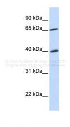 ARP30335_P050 - CHK2