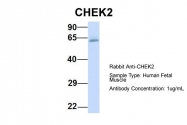 ARP30335_P050 - CHK2