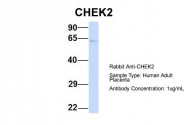 ARP30335_P050 - CHK2