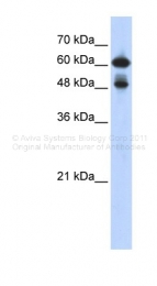 ARP30371_P050 - RELA / NF-kB p65