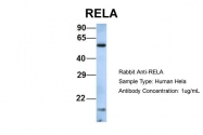 ARP30371_P050 - RELA / NF-kB p65